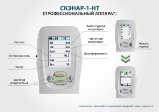 СКЭНАР-1-НТ (исполнение 01)  в Ивдели купить Скэнар официальный сайт - denasvertebra.ru 